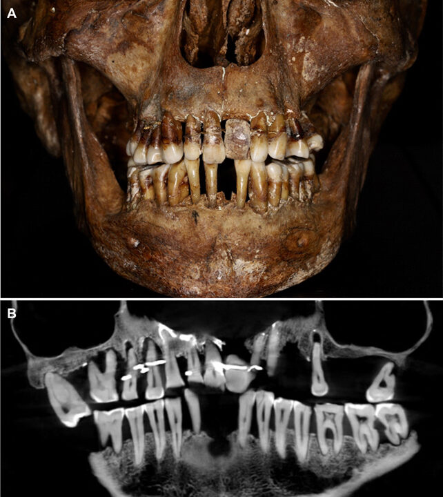 Click to enlarge teeth aristocrat