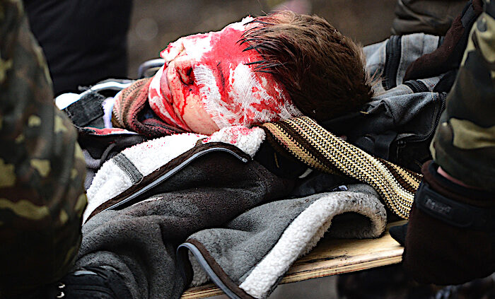 Injured