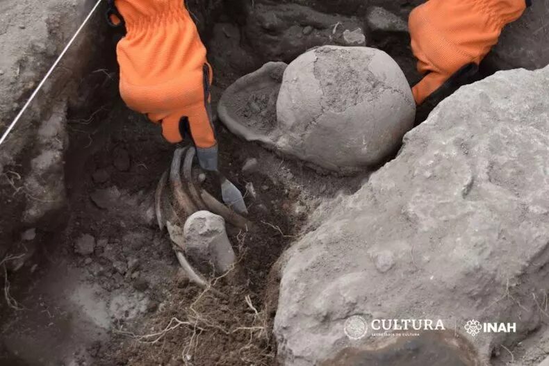 cranial deformation