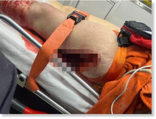 The woman sustained a gash on her leg just before 6 p.m. on Monday.