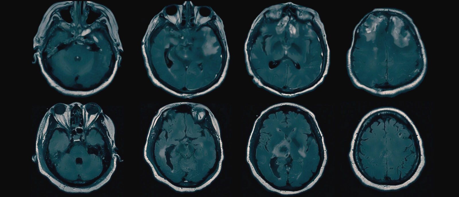 mri brain scans generic