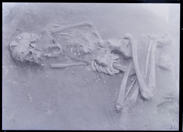 Click to enlarge deformed skull