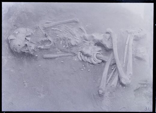 Click to enlarge deformed skull