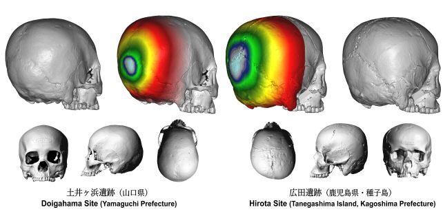 deformed skull