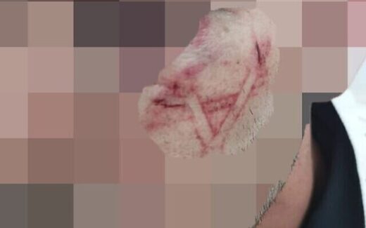 Cops accused of beating Palestinian detainee, branding him with Star of David