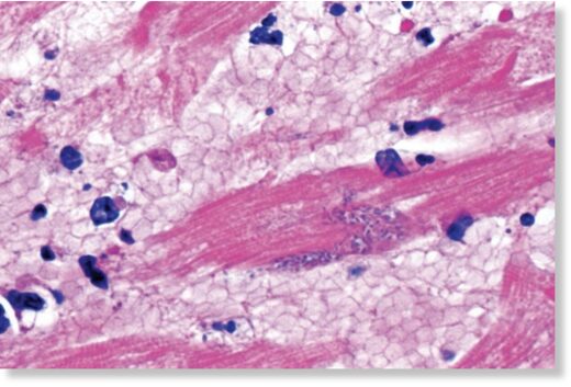 Click to enlarge myocardium