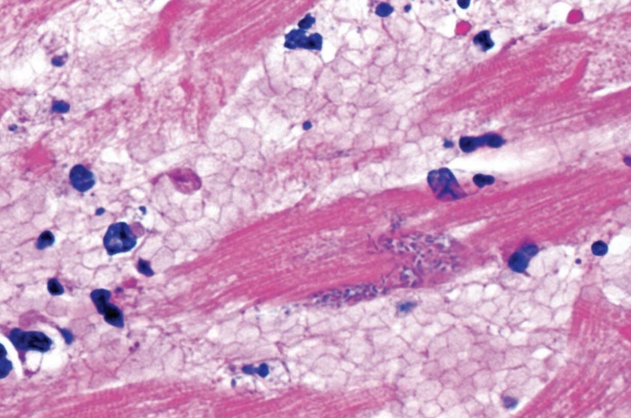 myocardium