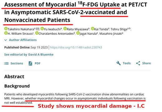 heart damage covid vaccine study