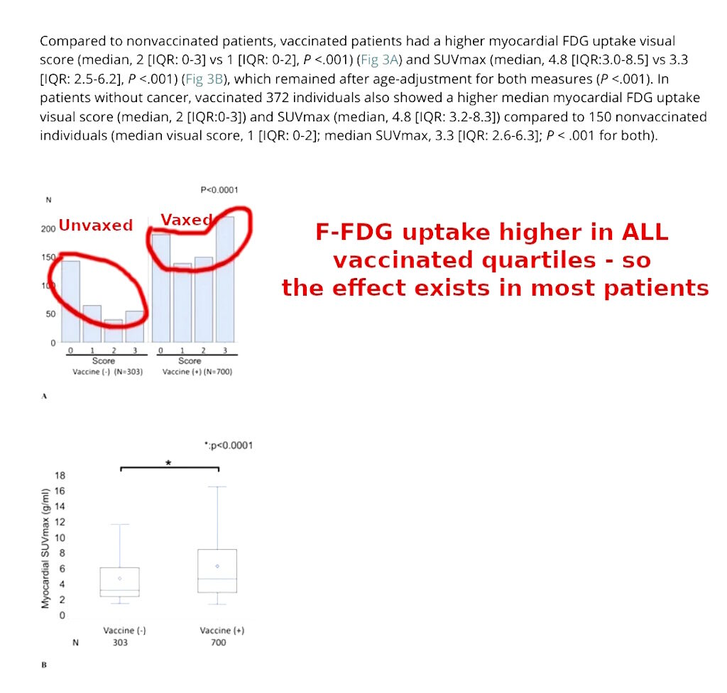 Click to enlarge covid vaccination f-fdg uptake heart damage