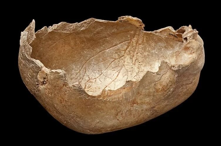 Click to enlarge Human Skull