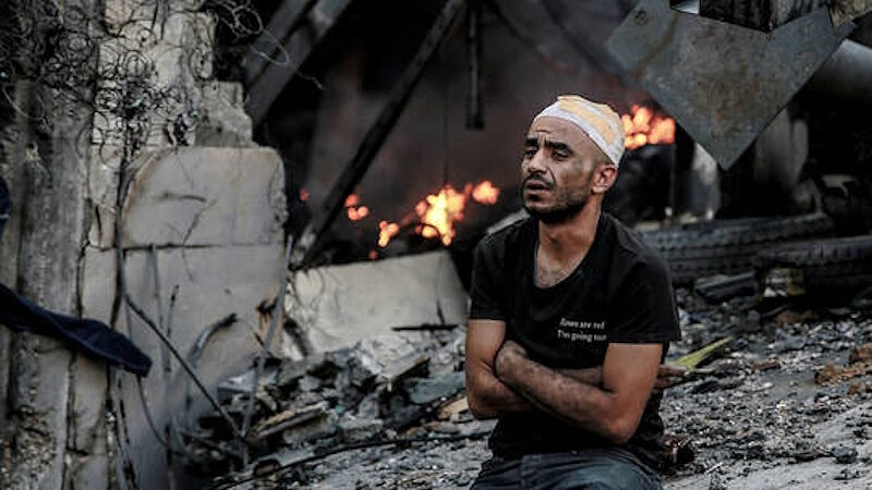 Click to enlarge man injured gaza october 2023