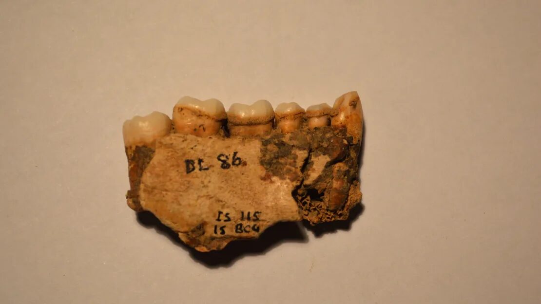 Click to enlarge Dental plaque