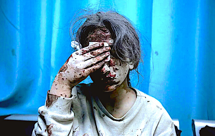 child bloody