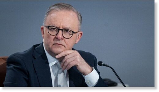 Click to enlarge anthony albanese