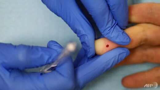 HIV test