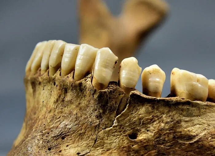 medeival teeth