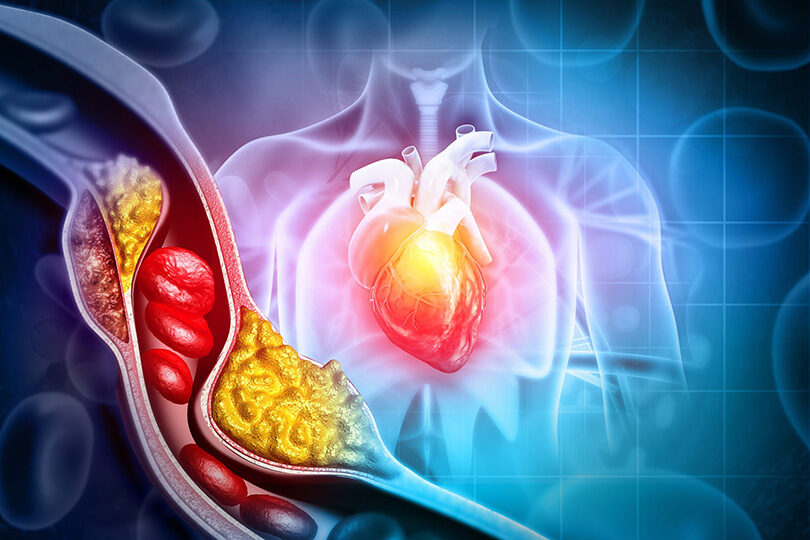 Heart Health