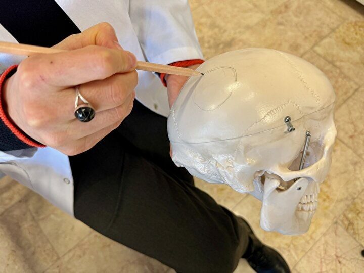Click to enlarge trepanated Skull