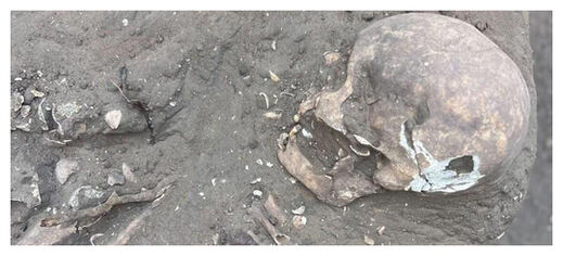 Click to enlarge Ancient Skull