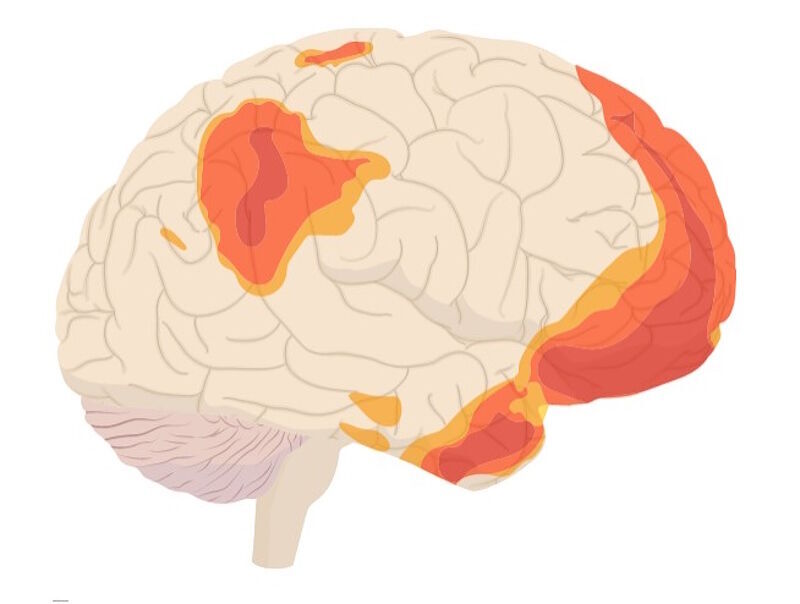 active areas brain at rest default mode