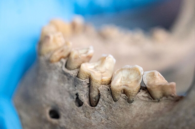 Click to enlarge canary islands skull worn teeth