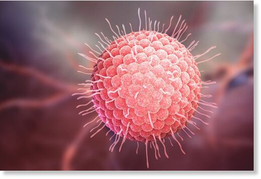 Click to enlarge shingles virus