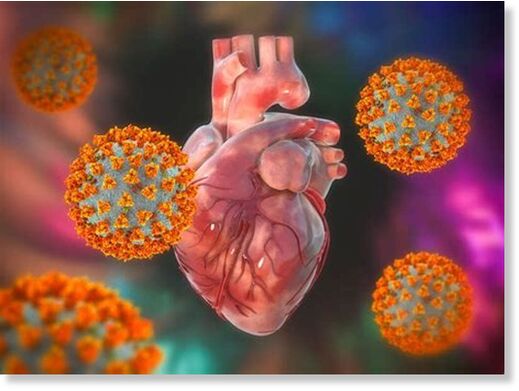 Myocarditis Post-Vaccination