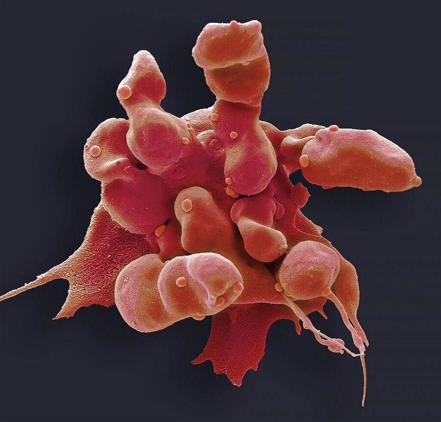 Click to enlarge kidney cell