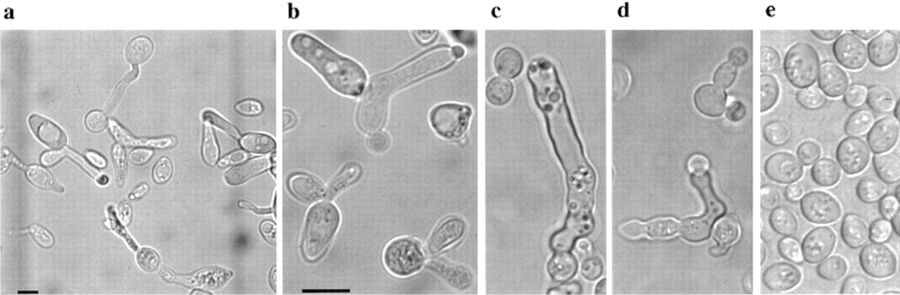 Click to enlarge apoptosis cell death yeast