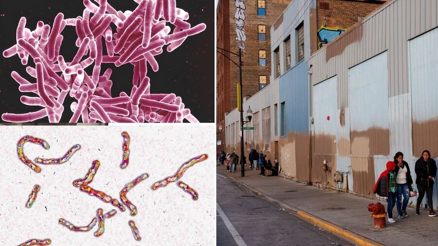 Tuberculosis under a microscopeChicago migrant shelter