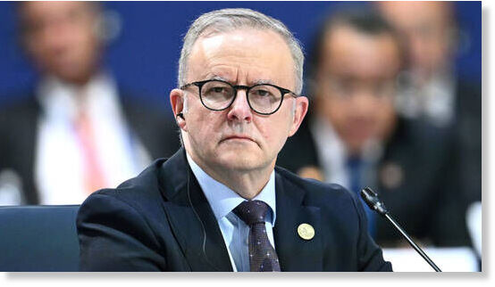 Anthony Albanese