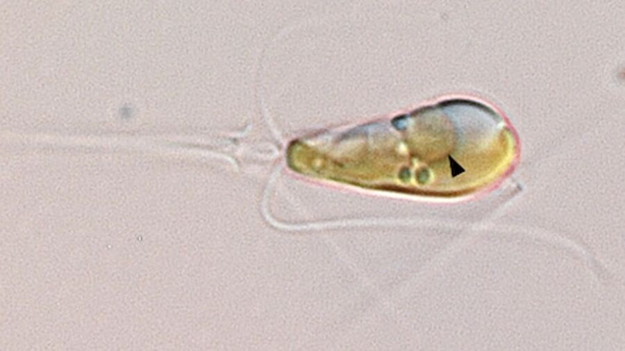 cell new organelle nitrogen fixer