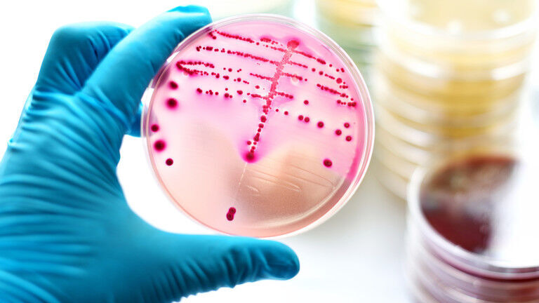 Click to enlarge streptococcal