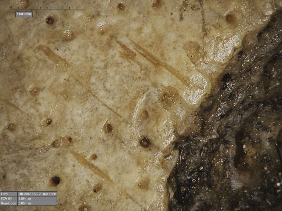 ancient egyptian skull surgery brain cancer