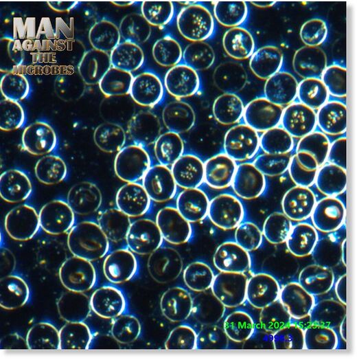 Click to enlarge Red blood cells with complex variation of internal structures
