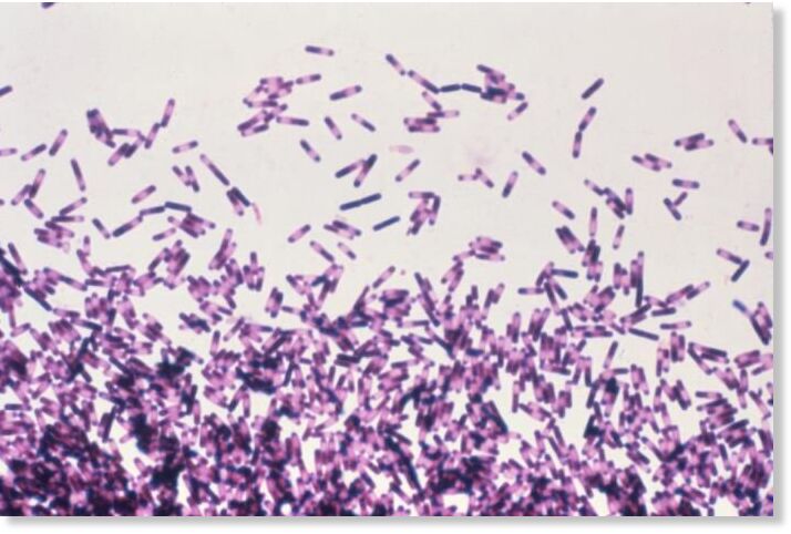 botulism