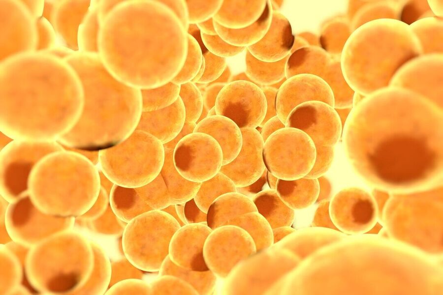 Click to enlarge fat globules