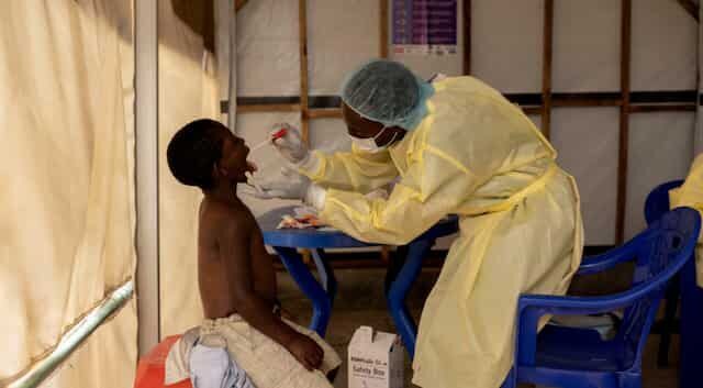 Click to enlarge mpox monkey pox