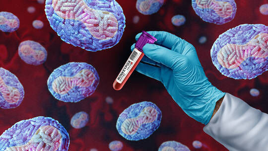 Monkeypox virus