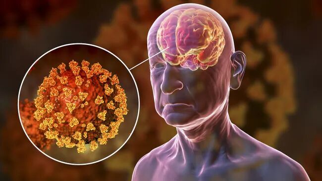 Click to enlarge covid virus back door brain infection