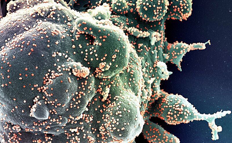 Click to enlarge virus