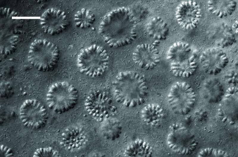 Click to enlarge Globular colonies of the choanoflagellate mono lake