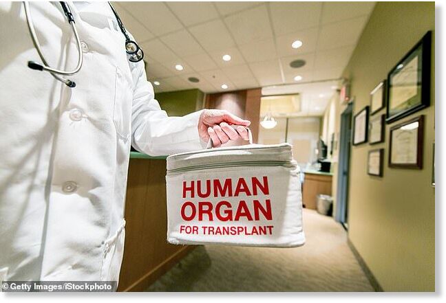 human organ transplant