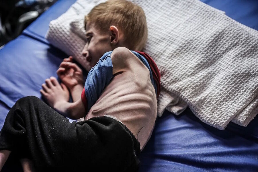 Click to enlarge starving child gaza blockade