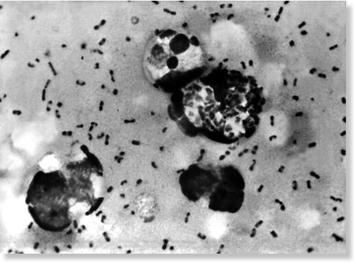 Click to enlarge The Yersinia pestis bacterium