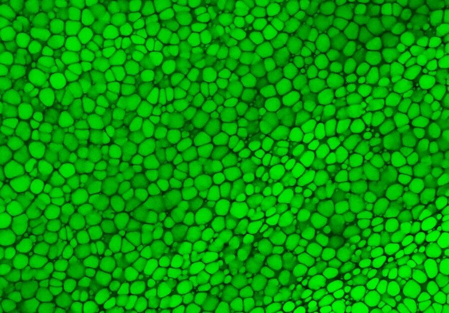 fat cartilage cells flexible tissue nose