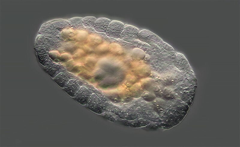 Click to enlarge Macrotrachela quadricornifera rotifer