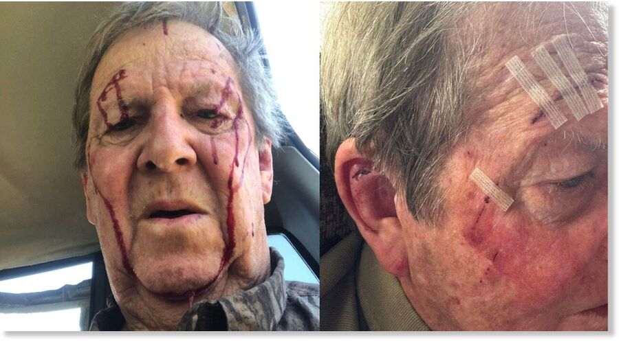 The bobcat grabbed Claude Strother from behind, clawing his face and narrowly missing his eyes.