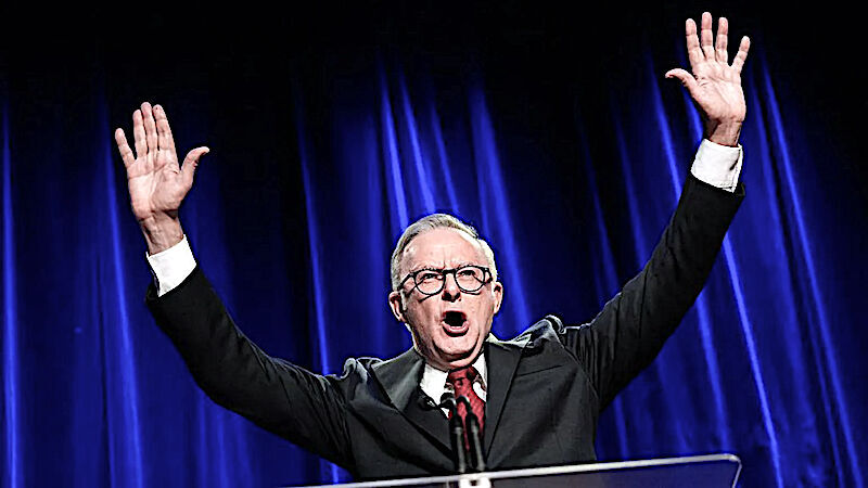 Click to enlarge Anthony Albanese