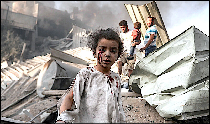 bloody child rubble